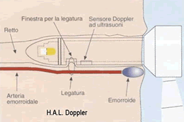 HAL DOPPLER